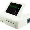 Monitor fetal CMS 8000g