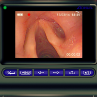 Video endoscop flexibil mbc5